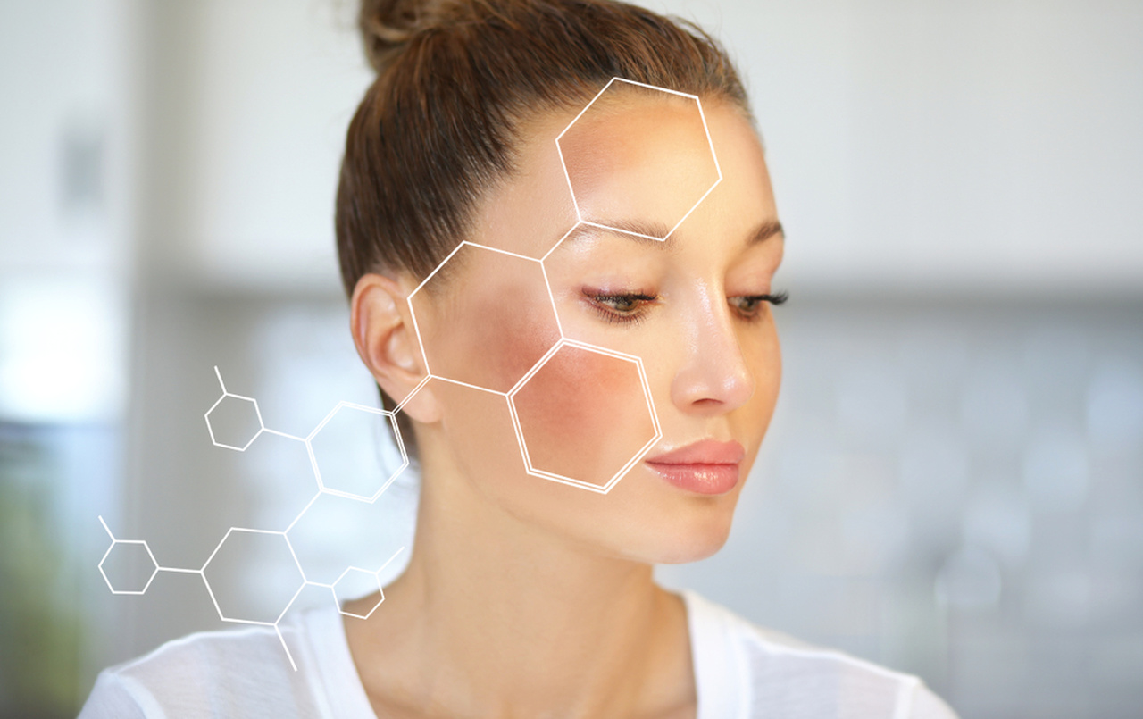 Melasma Extrafacial